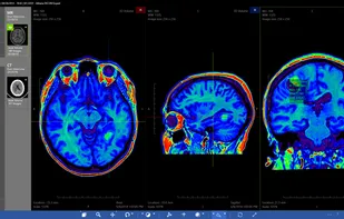 Athena DICOM Viewer screenshot 1