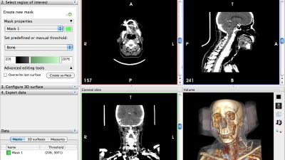 Multislice view and Volume Rendering