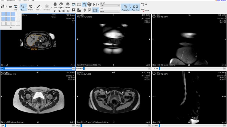 Starviewer medical imaging viewer AlternativeTo