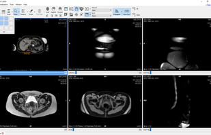 Starviewer screenshot 1