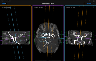 Falcon Viewer screenshot 1