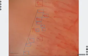 Capillary.io screenshot 1