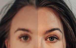 Photo Enhancer - EnhanceFox AI screenshot 2