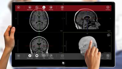 Navegatium delivers the best experience in exploring DICOM images On-the-GO.