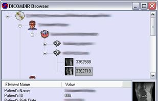 PowerDicom screenshot 1